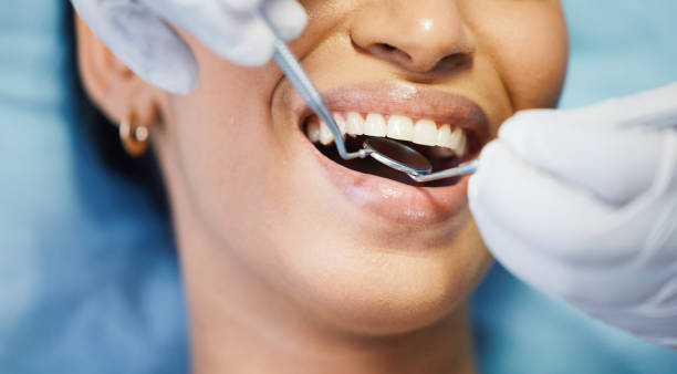 Best Emergency Dentist for Lost Fillings or Crowns in Hillsville, VA